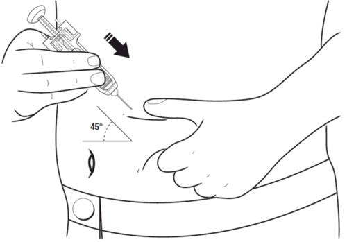 Mano che tiene una siringa inclinata a 45 gradi mentre l