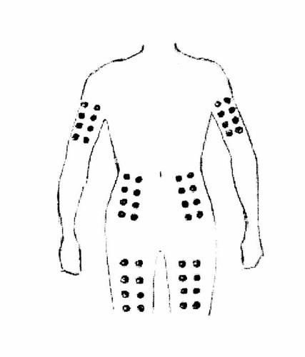 Schema del corpo umano con indicazioni di punti di iniezione su braccia, schiena e addome contrassegnati da piccoli cerchi neri