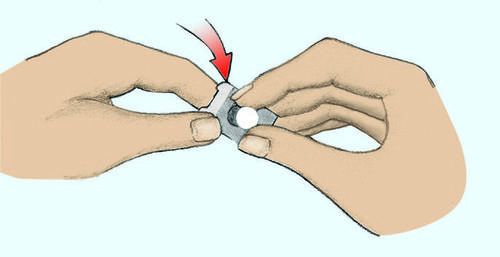 Mani che assemblano un dispositivo medico grigio e bianco con una freccia rossa che indica la direzione di inserimento