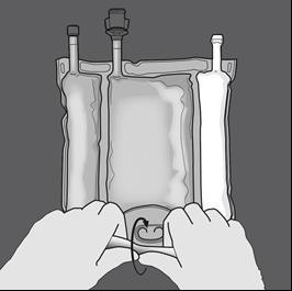 Sacche di infusione flessibili tenute da due mani con un connettore ad anello in primo piano