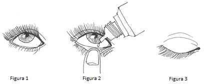 Occhio che riceve una goccia da un flacone contagocce, sequenza di applicazione con palpebra superiore e inferiore abbassate