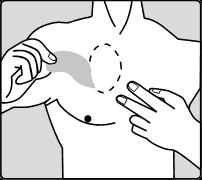 Mano che pizzica la pelle sul fianco con due dita, formando una piega, con un piccolo cerchio tratteggiato che indica il punto di iniezione