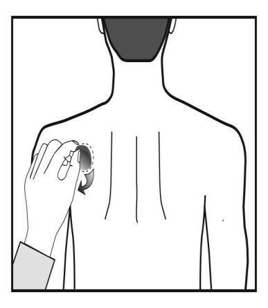 Mano che pizzica la pelle del braccio con unghie rivolte verso l