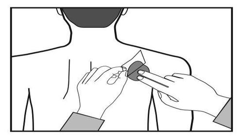 Mano che stringe un batuffolo di cotone con una pinzetta mentre l