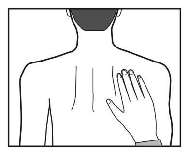 Schizzo di una mano che indica il punto di iniezione sulla parte superiore del braccio di una persona