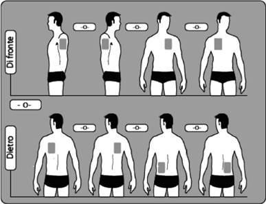 Uomini stilizzati di profilo e retro con aree ombreggiate che indicano possibili siti di iniezione sottocutanea o intramuscolare