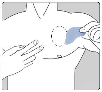 Mano che applica un cerotto blu su una zona del corpo indicata da un dito, con un piccolo segno a cerchio vicino