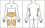 Schema del corpo umano con aree evidenziate in color pesca che indicano possibili siti di iniezione addominale e glutea