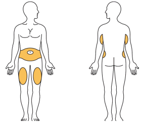 Schema corporeo umano con aree colorate in giallo che indicano possibili siti di iniezione sottocutanea su addome, fianchi e cosce