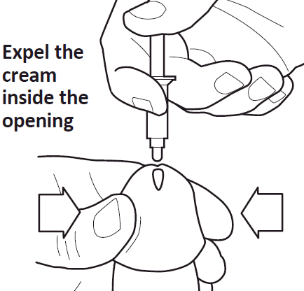 Mano che espelle la crema da una siringa nell