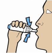 Mano che tiene uno spray nasale inserito in una narice con frecce blu che indicano la direzione di spruzzo