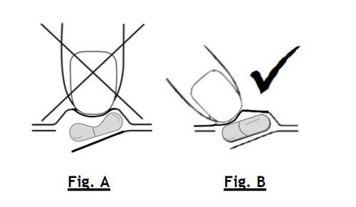 Posizionamento corretto e scorretto di capsule sublinguali, con indicazione di approvazione e divieto tramite spunta e croce