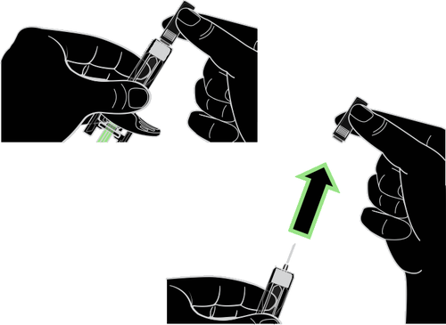 Mano che applica un adattatore alla siringa preriempita e dettaglio dell