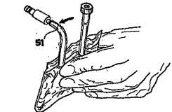 Mano con ago iniettato nel tessuto sottocutaneo, freccia indica l