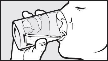 Mano che tiene un inalatore da cui fuoriesce una nuvola di vapore vicino alla bocca socchiusa