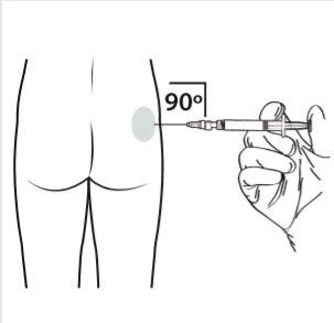 Iniezione sottocutanea nella coscia con siringa a 90 gradi indicata da un angolo e area di iniezione ombreggiata