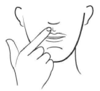 Mano che indica il punto di iniezione nella guancia, appena sotto il labbro inferiore, con disegno schematico