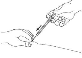 Mano che tiene una siringa preraempita con ago inserito nella pelle del braccio con freccia nera indicante la direzione