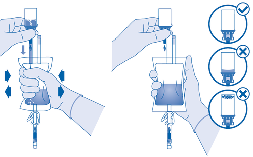 Mani con guanti che preparano una fiala medicinale con ago e siringa, frecce indicano la corretta e scorretta procedura di riempimento