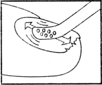 Mano che applica un cerotto adesivo su una ferita con piccoli fori, freccia curva indica la direzione di applicazione