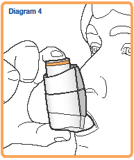 Mano che tiene un iniettore preriempito con stantuffo spinto e cappuccio protettivo arancione parzialmente rimosso