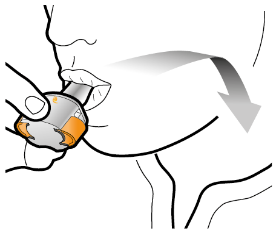 Mano che preme un dispositivo autoiniettante grigio e arancione con ago visibile inserito nella piega della pelle