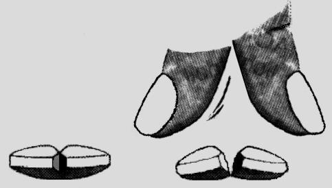 Sezione trasversale di un dente con radice biforcuta e vista della corona dentale spezzata in pi&ugrave; frammenti