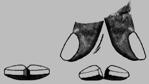 Sezione trasversale di un dente con evidenziata la polpa dentale e lo smalto in diverse viste e angolazioni