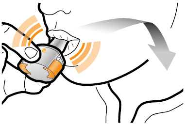 Mano che ruota un dispositivo autoiniettante sulla coscia con area arancione che indica il punto di iniezione