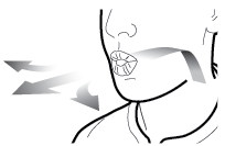 Iniezione sottocutanea nel braccio con ago inclinato e frecce che indicano la direzione di inserimento