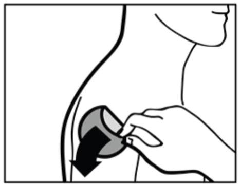 Mano che applica un cerotto adesivo sulla pelle del braccio con una freccia nera che indica la direzione di applicazione