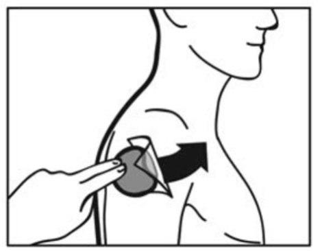 Mano che applica un cerotto medicinale sulla clavicola con una freccia nera che indica la direzione