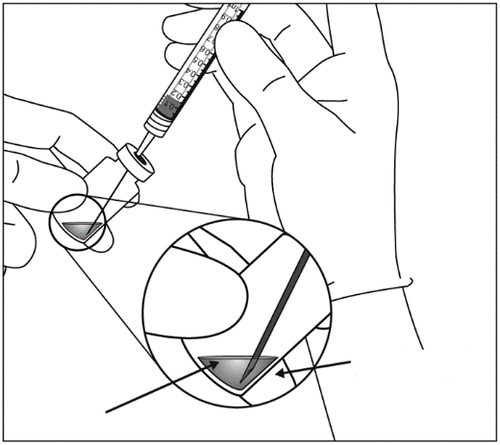 Mano che tiene una siringa con ago inserito nel tessuto sottocutaneo, freccia indica l