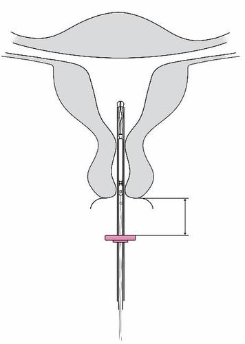 Sezione schematica dell