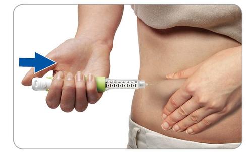 Mano che afferra un dispositivo per iniezione precompilato mentre l