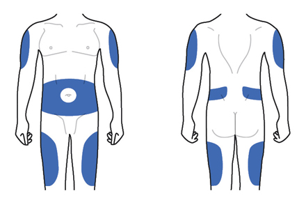 Schema del corpo umano con aree evidenziate in blu che indicano i siti di iniezione intramuscolare su braccia, cosce e glutei