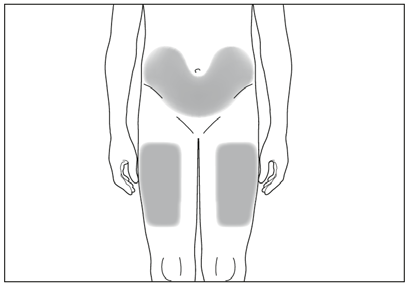 Schema del corpo umano con aree ombreggiate che indicano i siti di iniezione nella regione glutea e cosce