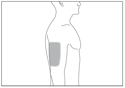 Profilo di una persona con area grigia che indica la regione deltoidea del braccio superiore