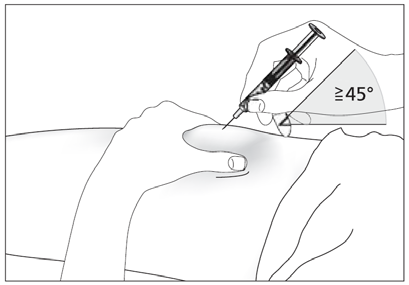 Mano che inietta farmaco sottocute con siringa a 45 gradi, angolo indicato da simbolo &ge;45&deg;, su braccio umano stilizzato