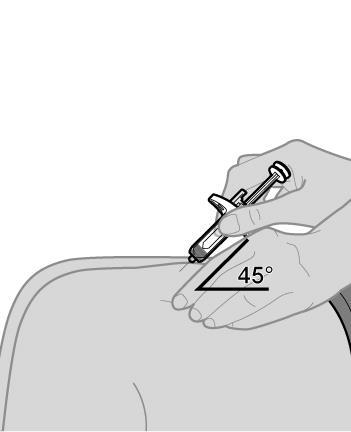 Mano che tiene una siringa con ago inclinato di 45 gradi sopra la pelle del braccio con indicazione dell