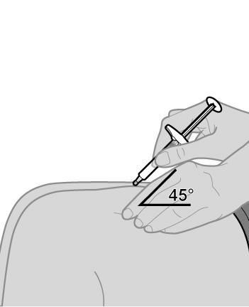 Mano che tiene una siringa inclinata di 45 gradi mentre inietta un farmaco nel braccio di un paziente con pelle grigia