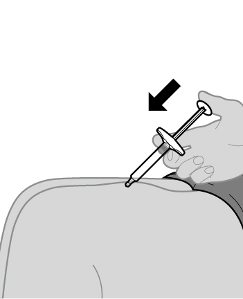 Iniezione sottocutanea con siringa nell