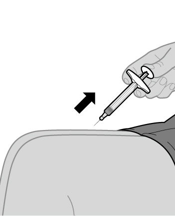 Iniezione sottocutanea con siringa e ago inserito nell