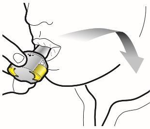 Dispositivo autoiniettante con ago inserito nella pelle, freccia grigia indica direzione di iniezione, aree gialle evidenziano punti di pressione
