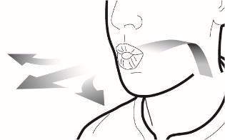 Profilo del viso con frecce grigie che indicano la zona di iniezione intramuscolare nella guancia e nella mandibola