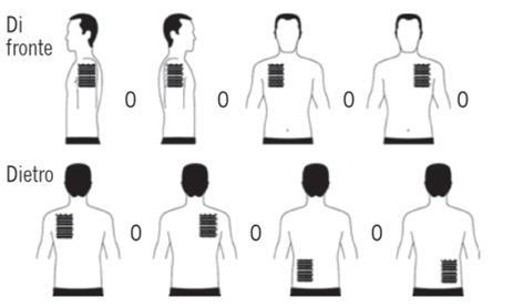 Schizzi di figure umane da davanti e dietro con aree ombreggiate sul torace e sulla schiena indicanti siti di iniezione