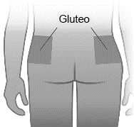 Vista posteriore del bacino umano con indicazione del gluteo evidenziato in grigio e frecce direzionali