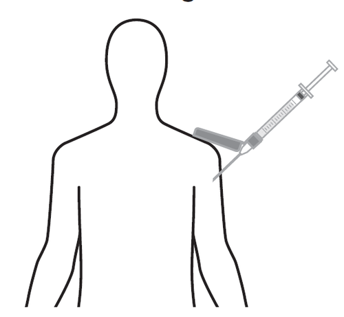 Schema di iniezione sottocutanea con siringa e ago posizionati nell