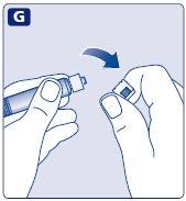 Mani che assemblano un dispositivo medico con una freccia blu che indica la direzione di inserimento