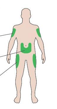 Schema corporeo umano con aree evidenziate in verde per iniezioni intramuscolari su braccia, glutei e cosce